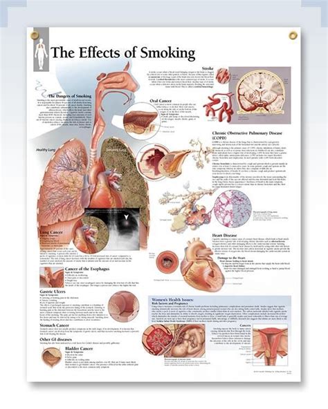 The Effects Of Smoking Chart 22x28 Smoking Effects Pulmonology