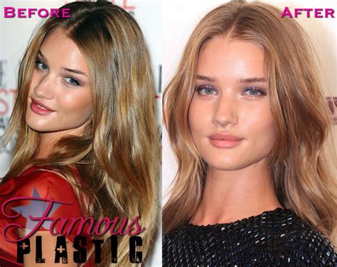 did rosie huntington whiteley had plastic surgery nose job and lip 43032 hot sex picture