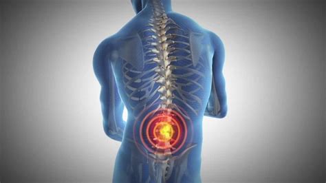 Si Joint Pain A Common Source For Low Back Pain Fx Chiropractic