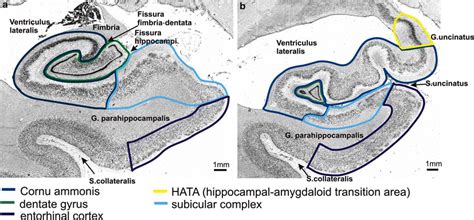 Cytoarchitectonic Mapping Of The Human Amygdala Hippocampal Region And