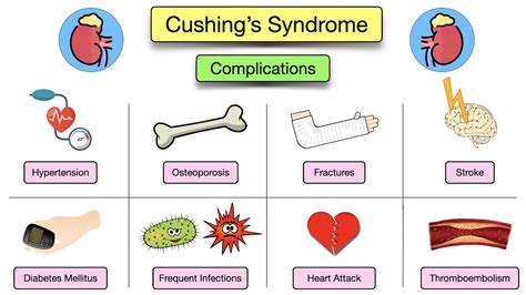 Cushings Syndrome Symptoms Causes Treatment Diagnosis Definitions