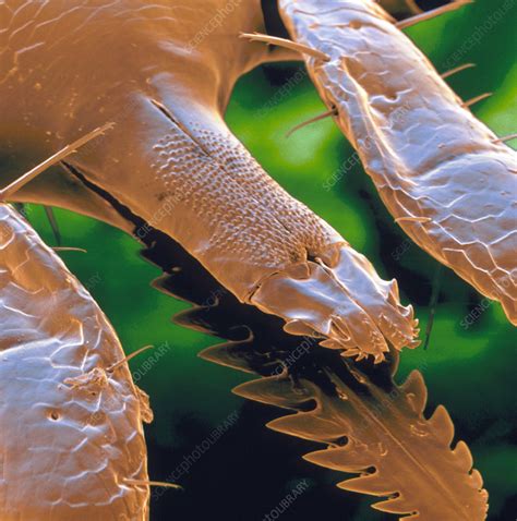 Coloured Sem Of Lyme Disease Tick Mouthparts Stock Image Z4450222