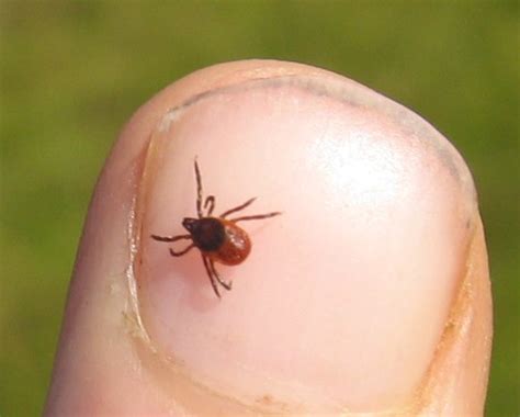 Think Youre Seeing More Ticks The Capes Entomologist Says Its Not
