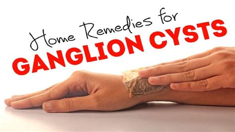 How Do You Get Rid Of Ganglion Cyst On Finger Damian Moore Kapsels
