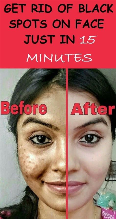 Pin On Face Care