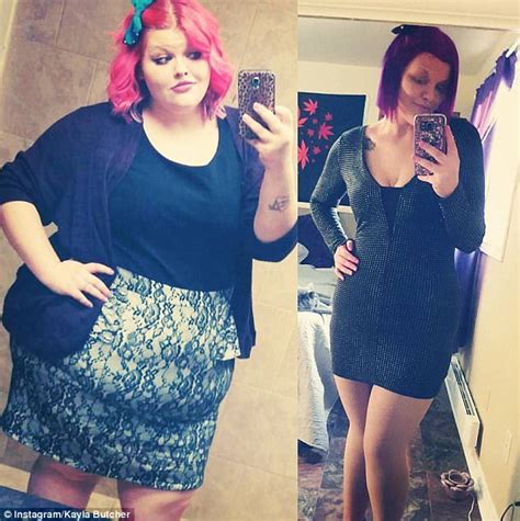 Woman Who Lost 186lbs Left With Apron Of Excess Skin Daily Mail Online