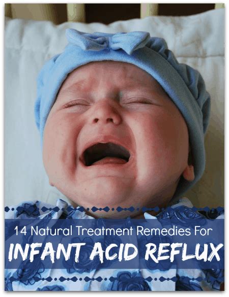 14 Natural Ways To Deal With Infant Acid Reflux And Gerd Trimester Talk