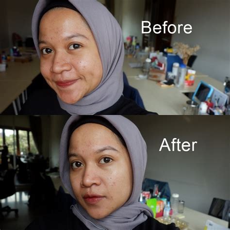 Bagi yang punya eczema seperti saya (cari tahu tentang eczema di sini!) maka ini saya kurang tahu bagaimana reaksinya kalau dipakai bareng dengan vitamin c serum, tapi sebaiknya sih tetap ikutin aja langkah aslinya. Kulit Jadi Terasa Kering Setelah Mencoba ERTO'S Facial ...