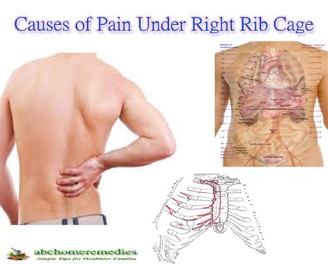 Causes Of Pain Under Right Rib Cage Home Remedies