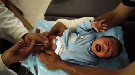 The Pros And Cons Of Circumcision Weighing The Evidence Chicagojewishnews Com