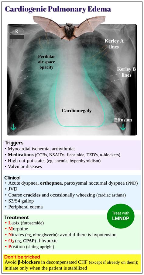 Cardiogenic Pulmonary Edema Medicine Keys For Mrcps