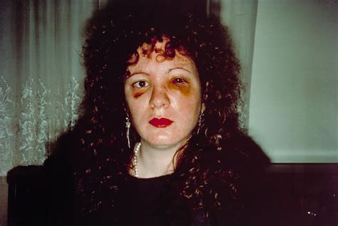 ‘nan One Month After Being Battered Nan Goldin 1984 Tate