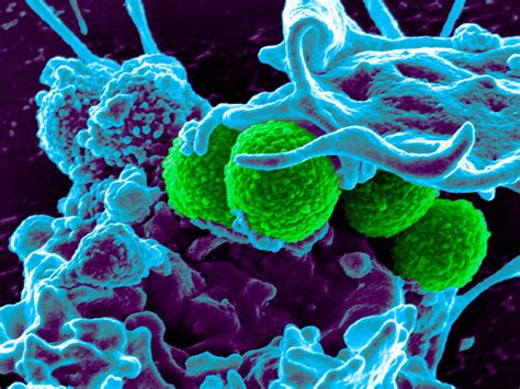 Human Virus Hybrid Created To Kill Off Antibiotic Resistant Mrsa