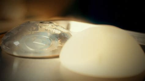 Fda Takes Action On Breast Implant Safety Concerns Nbc 5 Dallas Fort