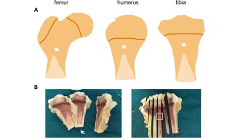 A Regions In The Proximal Metaphysis Of The Femur Humerus And Tibia
