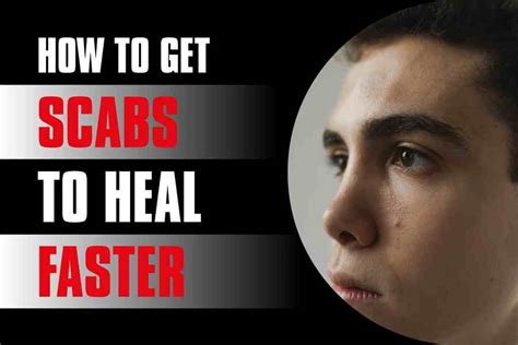 How To Get Scabs To Heal Faster Ultimate Guide Americas Wire