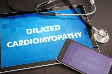 Concep Médico Dilatado De La Diagnosis De La Cardiomiopatía Desorden