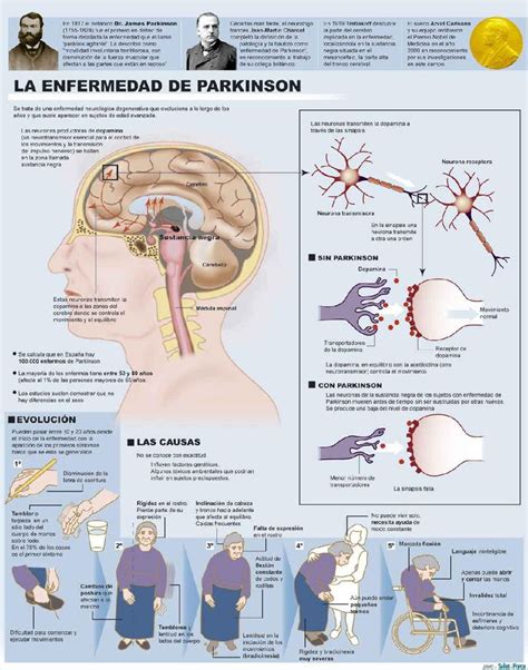 Pin De Oliviero Trucco En Parkinson Research Enfermedad De Parkinson