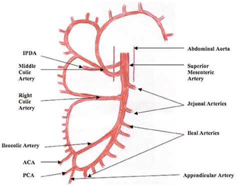Ileocolic Artery Meddic