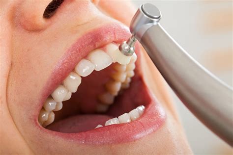 Fluoride Treatments Manchester Strengthen Teeth Tooth Enamel