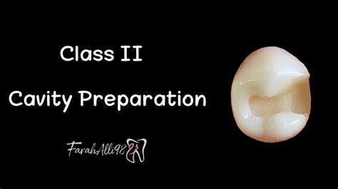 Class 2 Cavity Preparation On Lower Second Premolar Farahalli98 فرح