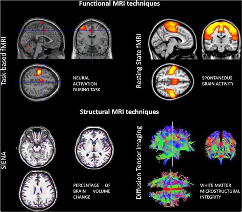 The Fmri Technique Makes Use Of Activity Dependent Changes In