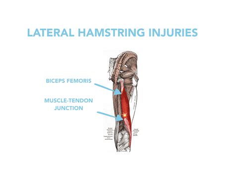 Flow Physio Co Flow Knows Hamstring Injuries