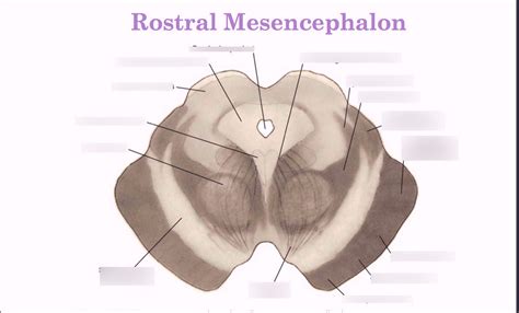 Structures Of The Rostral Mesencephalon Diagram Quizlet