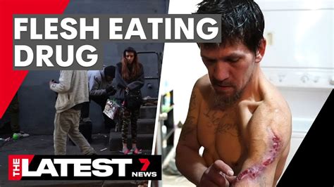 The Flesh Eating Drug Taking Over America 7news