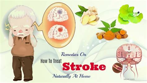 29 Remedies On How To Treat Stroke Naturally At Home