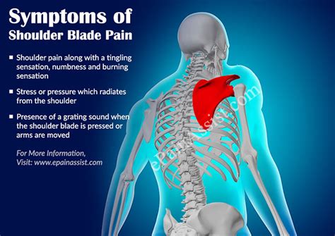 Shoulder Blade Pain Symptoms Causes Types Treatment Exercise