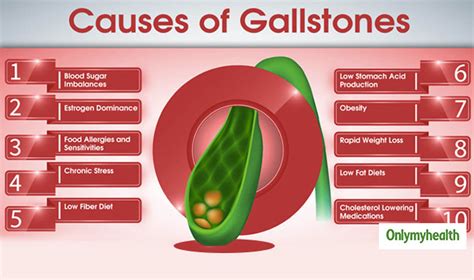 Gallstone High Risk Groups Diagnosis And Prevention Tips For