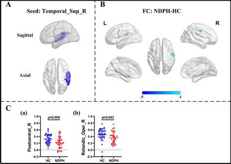 Fc Analysis From Right Superior Temporal Gyrus To The Whole Brain