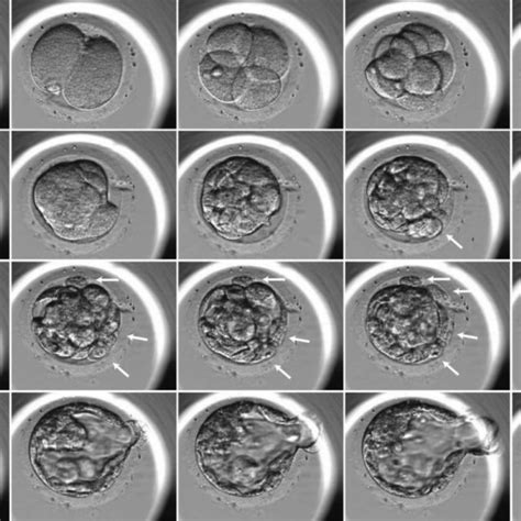 Time Lapse Embryoscope Photography Of Embryo Expelling Cell