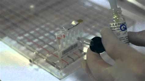 Using Blood Grouping Reagents Gel Card Technique Lorne Laboratories