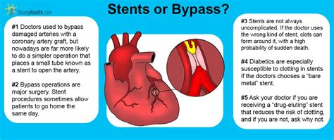Stents Or Bypass Which Is Safer For Diabetics