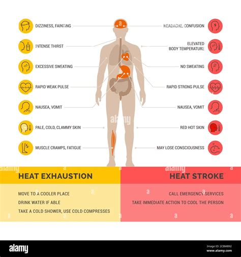 Heat Exhaustion And Heat Stroke Healthcare Infographic Symptoms And First Aid Stock Vector