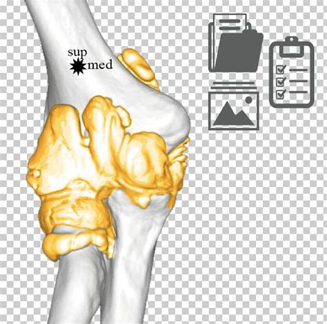 Thumb Ulnar Nerve Elbow Joint Humerus Png Clipart Arm Arthrology Bone Elbow Finger Free