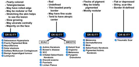 Is It Skin Cancer An Algorithm For Diagnosis