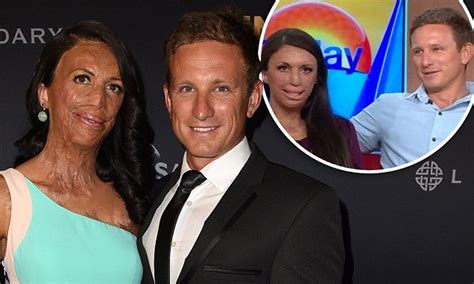 He Didn T Get Down On One Knee Turia Pitt Opens Up About Proposal Proposal Pitt Today Show