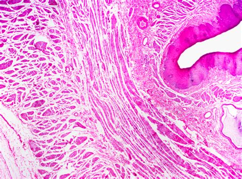 Stomach Histology Esophagus Stomach Junction Histology Slide Sexiz Pix