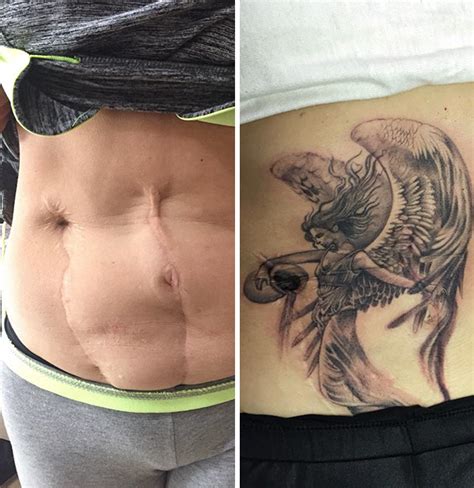 55 Incredible Scar Tattoo Cover Ups Transforming Imperfections Into
