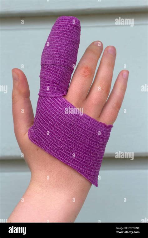 Closeup Of A Young Womans Sutured Finger Covered By Winding Layers Of