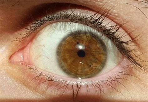 Why Do Some Adults Have Small Pupils In One Or Both Eyes