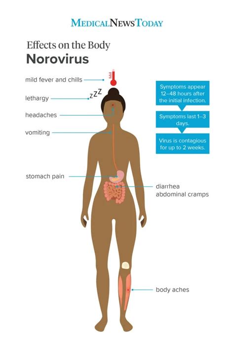 Norovirus Symptoms Treatment And Prevention
