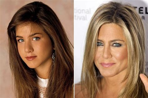 Face Plastic Surgery Nose Surgery Jennifer Aniston Nose Reshaping