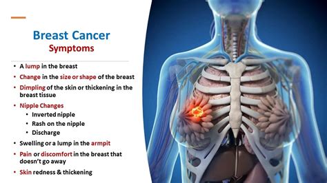 Breast Cancer A Short Summary