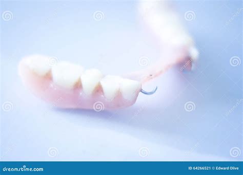 Removable Partial Denture For Upper Teeth Isolated On White Background
