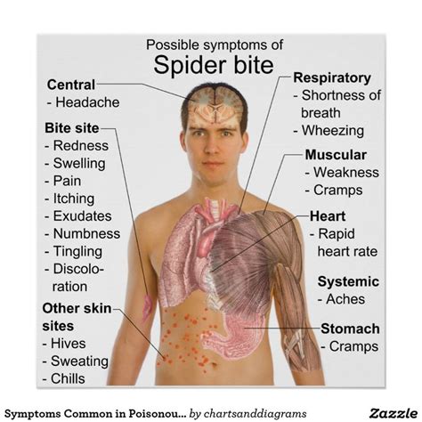 Signs Of A Poisonous Spider Bite Symptoms Common In Poisonous Spider Bite Symptoms Spider