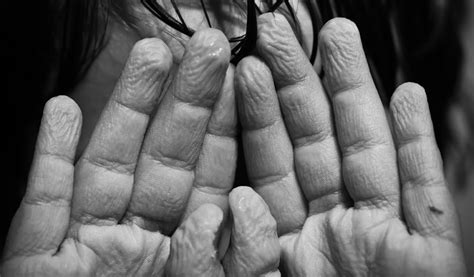 Getting A Handle On Why Fingers Wrinkle Science Friday
